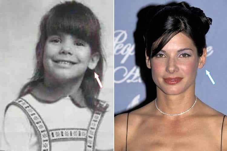 Has Sandra Bullock Had Plastic Surgery? (Before & After