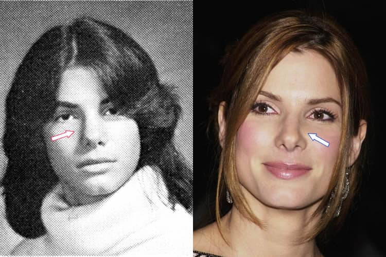 Has Sandra Bullock Had Plastic Surgery? (Before & After