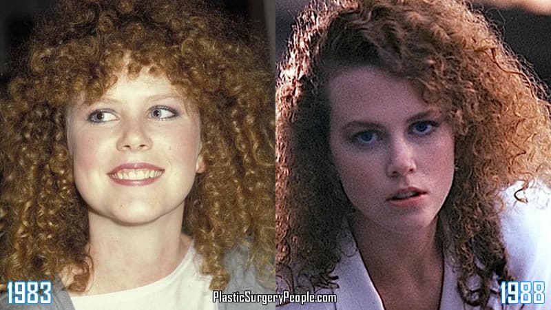 Nicole Kidman 1983 & 1988