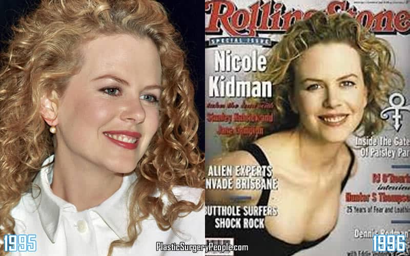 1995 - 1996 Were Nicole's Breasts Real or Fake?