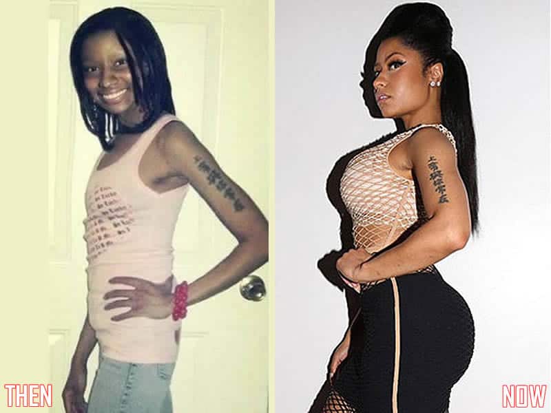 Image result for nicki minaj before and after plastic surgery