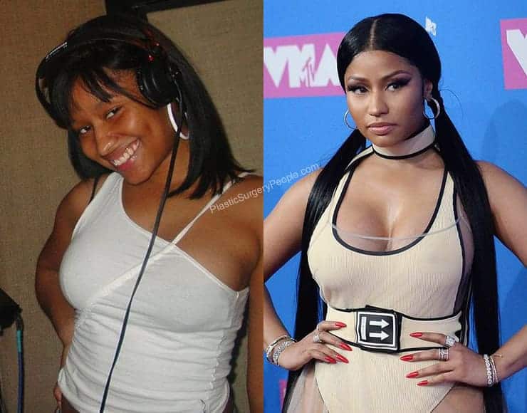 Boobs nicki minaj Nicki Minaj