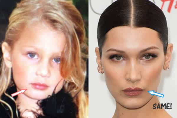 Bella's lips before and after