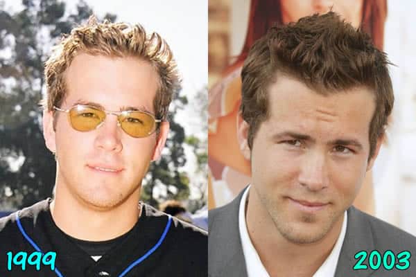 Ryan Hair Before and After