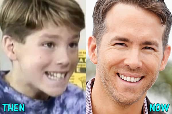 Ryan's crooked teeth fixed