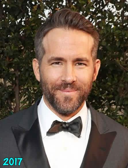 Ryan is losing hair again in 2017