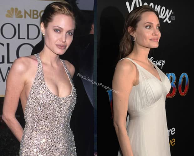 Angelina Jolie Boob Job