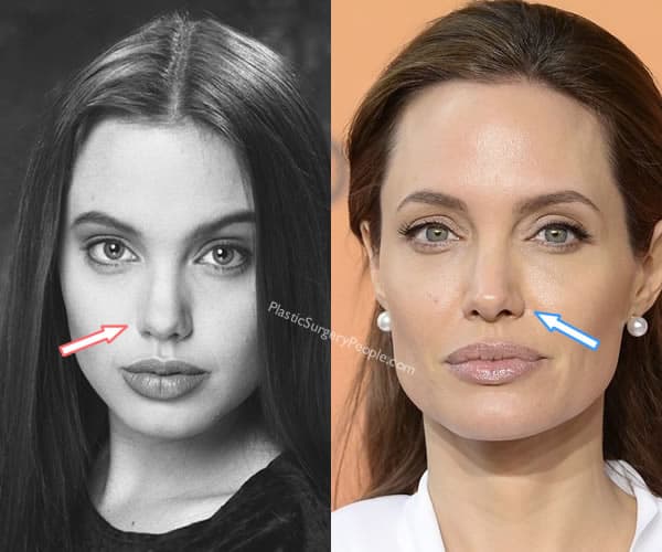 600px x 500px - Is 'Plastic Surgery' Angelina Jolie's Beauty Secret?