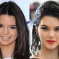 Kendall Jenner Plastic Surgery