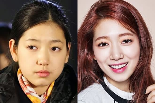 free park shin hye plastic surgery