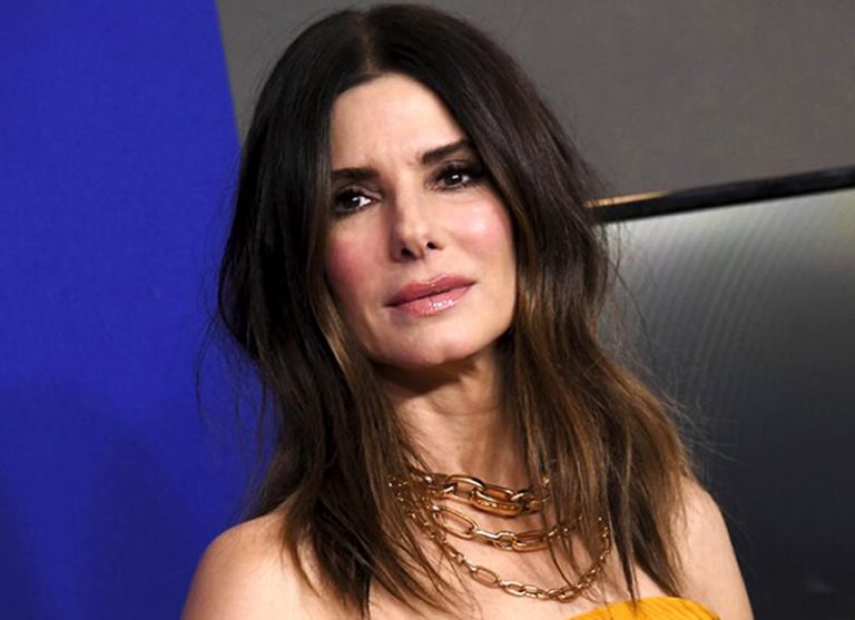 Did sandra bullock have plastic surgery before after 2021 