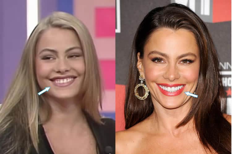 free sofia vergara plastic surgery