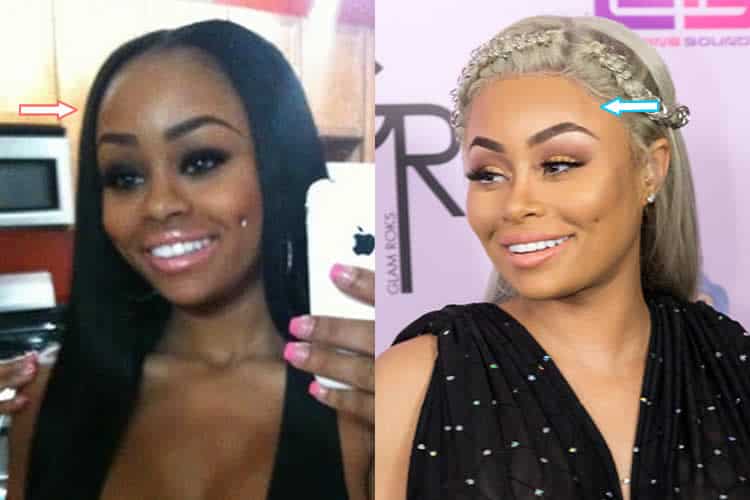 Did Black Chyna Have Plastic Surgery Before And After 2021