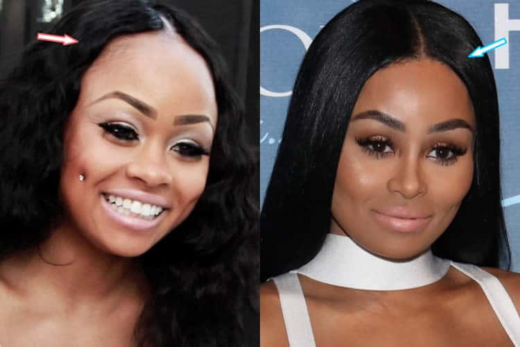 Did Black Chyna Have Plastic Surgery? (Before & After 2021)