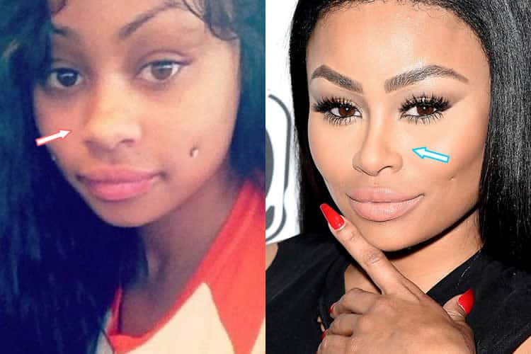 Blac Chyna nose job before and after photo