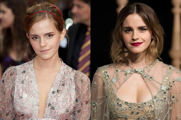 Emma Watson Millie Fucking - Emma Watson Breast Reduction - Emma Watson Age