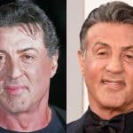 Sylvester Stallone's face before facelift and botox?