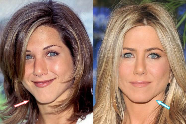 Jennifer Aniston's Chin