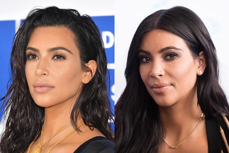 Kim Kardashian Plastic Surgery REVEALED! (Before & After Pics 2018)