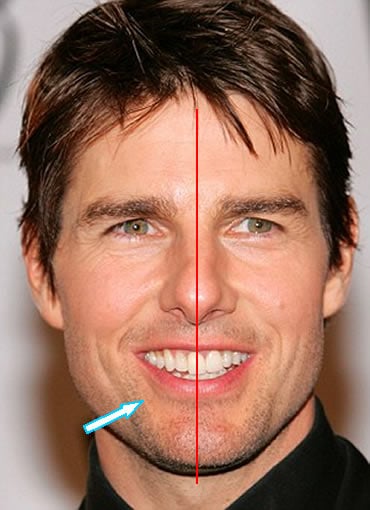 what is tom cruise teeth