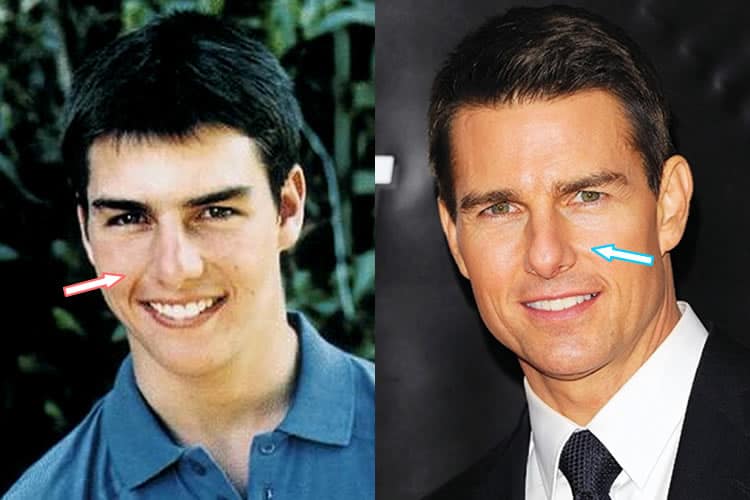 Tom Cruise Is Becoming Younger With Help Of Plastic S - vrogue.co