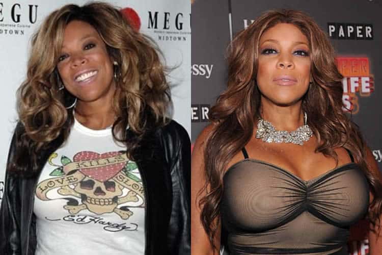 Did Wendy Williams Have A Boob Job? 