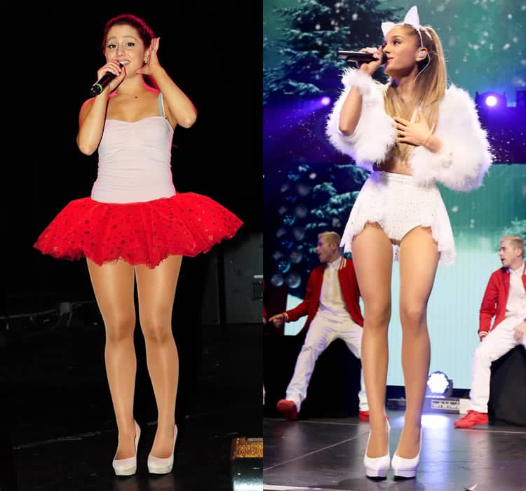 Has Ariana Grande Had Liposuction On Her Legs? 