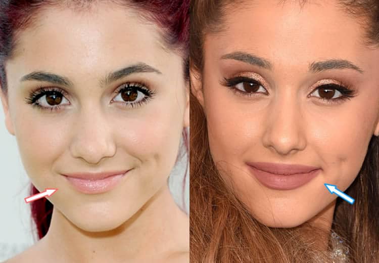 Has Ariana Grande Had Plastic Surgery? (Before & After Photos)
