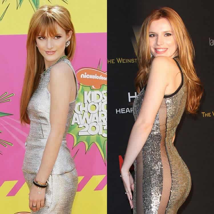 Bella Thorne butt lift before and after photo