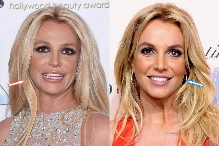 Did Britney Spears Have Cosmetic Surgery? (Before & After 2018)