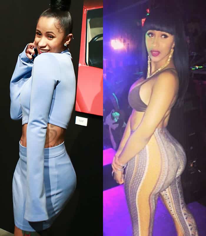 Cardi B butt lift before and after photo