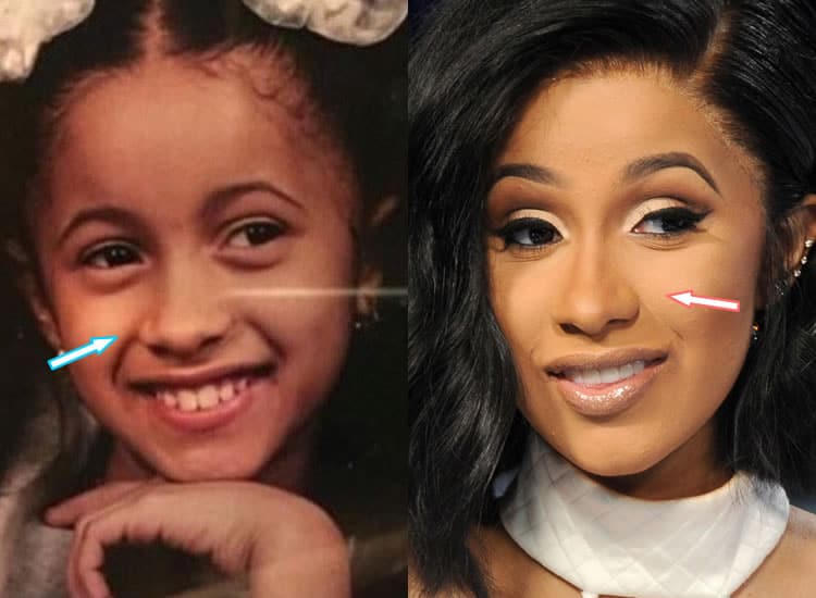 Has Cardi B had a nose job? 