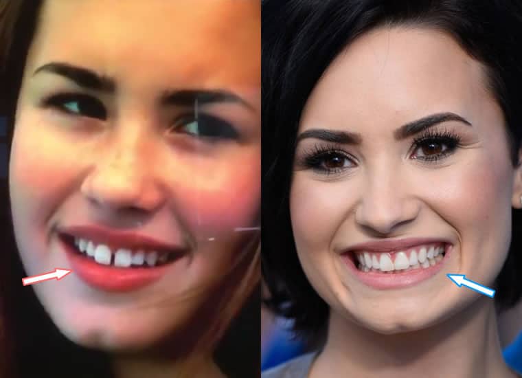 demi lovato gapped teeth demi lovato gapped teeth