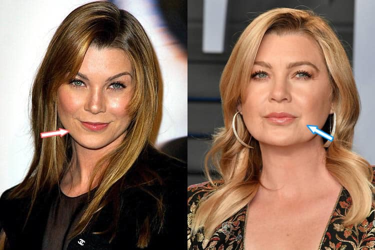 Has Ellen Pompeo Had Cosmetic Surgery Before Amp After Photos