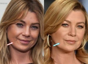 Has Ellen Pompeo Had Cosmetic Surgery? (Before & After Photos)
