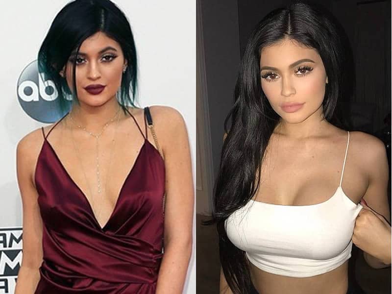 Did Kylie Jenner Have A Boob Job? 