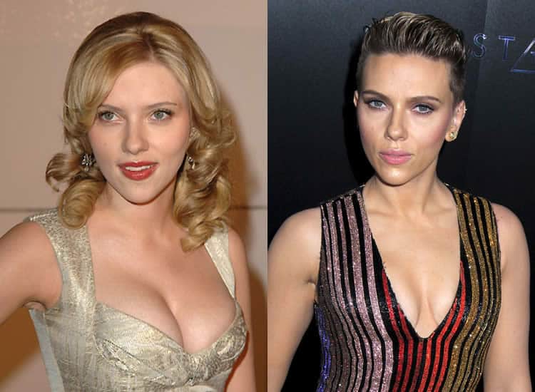 Has Scarlett Johansson Have Breast Reduction Surgery? 