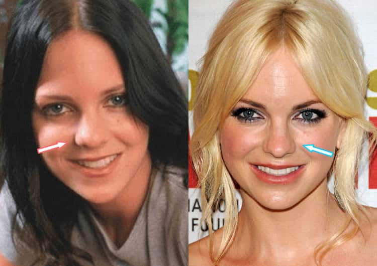 Anna Faris Plastic Surgery Revealed Before After Pics 2018