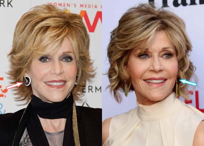 Did Jane Fonda Have Plastic Surgery? (Before & After 2018)