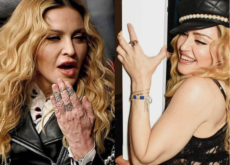 What Happened To Madonna's Hands?