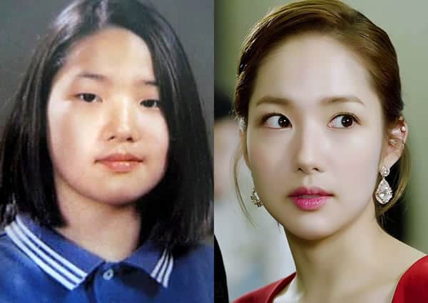 Park Min Young Before and After Plastic Surgery?