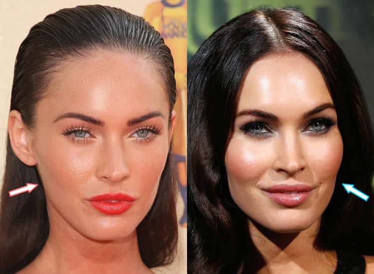 Has Megan Fox Had Cosmetic Surgery?