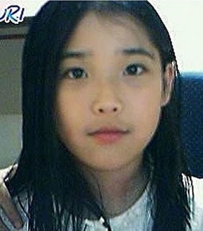 Korean Singer IU Before and After Surgery?