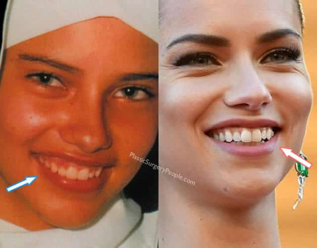 Adriana Lima's Teeth.