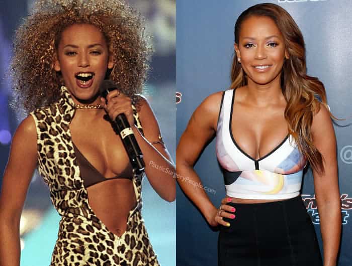 Did Mel B Have Boob Job? 