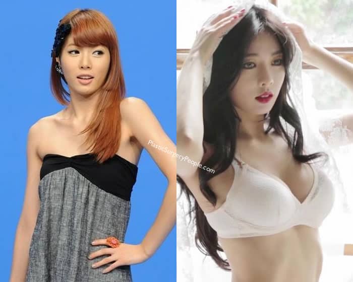 Is Korean Idol Hyuna A Real Natural Beauty