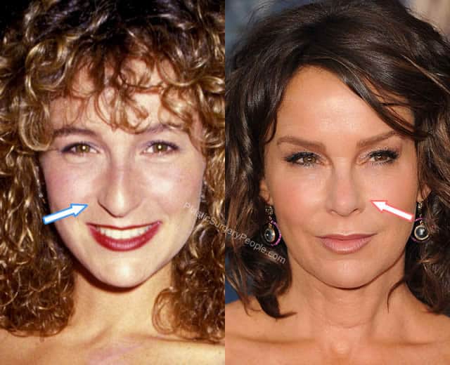 did-jennifer-grey-ever-touched-her-nose-face-body