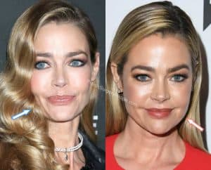 Denise Richards: BEFORE and AFTER 2019