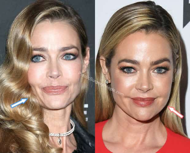 Denise Richards Before And After 2019