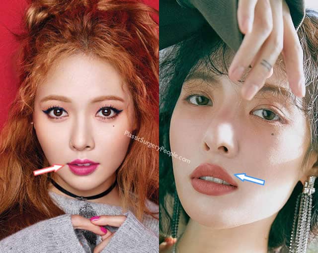female kpop idols with "small" lips? | Page 2 | allkpop Forums
